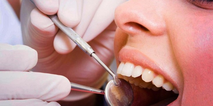 Salud Bucodental: La importancia de conservar todos nuestros dientes