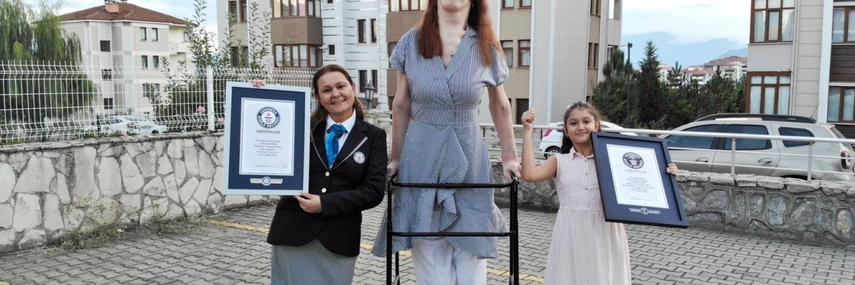 Rumeysa Gelgi la mujer más alta del mundo, Conoce su historia y su padecimiento