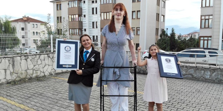 Rumeysa Gelgi la mujer más alta del mundo, Conoce su historia y su padecimiento