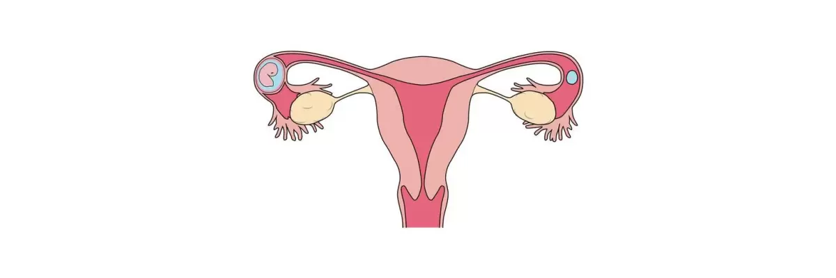 Cuanto tarda en cerrarse el útero después de un aborto con Misoprostol