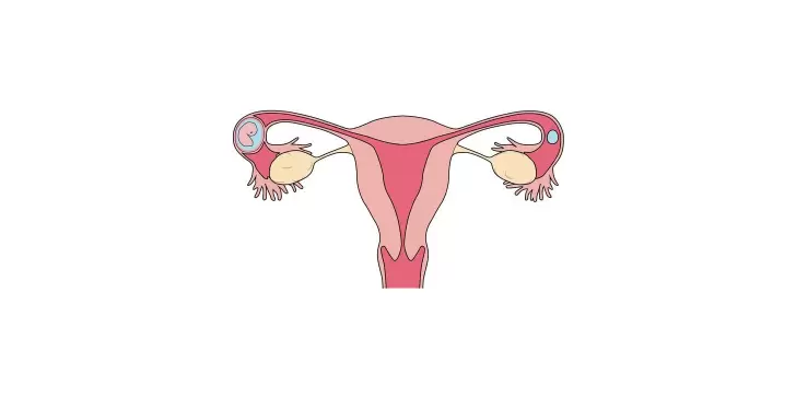 Cuanto tarda en cerrarse el útero después de un aborto con Misoprostol