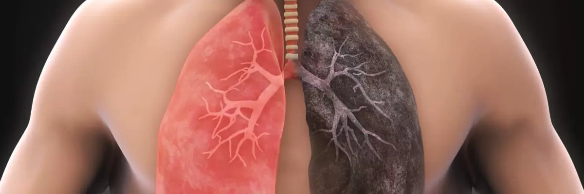 Salud Pulmonar: Conoce las señales que te muestra tu cuerpo sobre el funcionamiento de tus Pulmones.