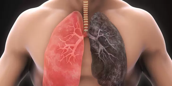 Salud Pulmonar: Conoce las señales que te muestra tu cuerpo sobre el funcionamiento de tus Pulmones.